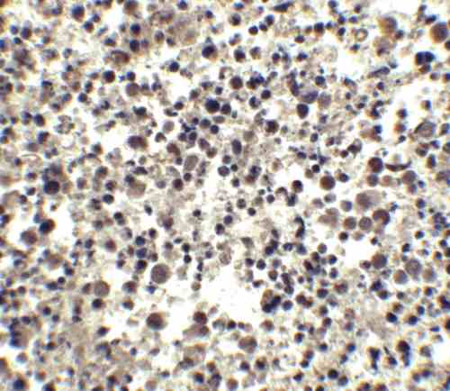 IHC rabbit anti cide a ct polyclonal antibody 5987