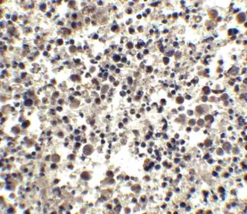 benchmark-antibodies_anti-cide-a_ct_antibody_5987_6.gif