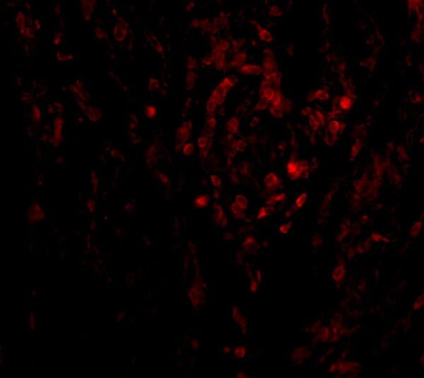 ICC/IF rabbit anti ciks act1 nt polyclonal antibody 9655