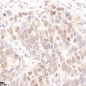 Western blot rabbit anti ckii alpha polyclonal antibody 2271