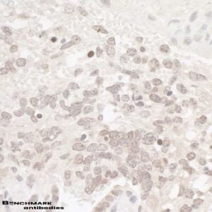 IHC rabbit anti ckii alpha polyclonal antibody 6767