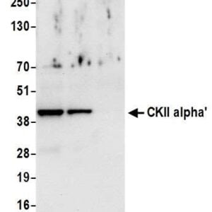 IHC rabbit anti ckii alpha polyclonal antibody 7489