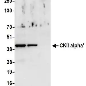 IHC rabbit anti ckii alpha polyclonal antibody 7489