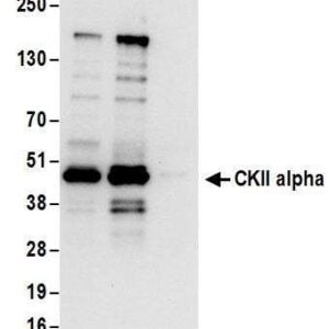 Western blot rabbit anti ckii alpha polyclonal antibody 7989