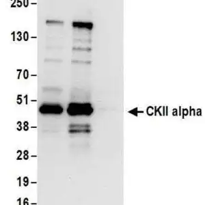 Western blot rabbit anti ckii alpha polyclonal antibody 7989