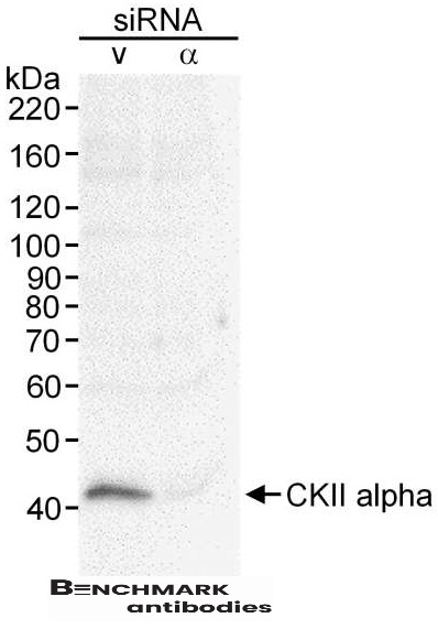benchmark-antibodies_anti-ckiialpha_antibody_7989_2.jpg