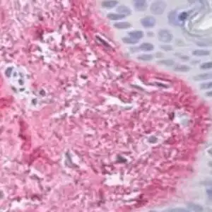 IHC mouse anti collagen v alpha 1 chain nc2 domain monoclonal antibody 13f6 7366