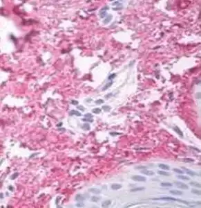 IHC mouse anti collagen v alpha 1 chain nc2 domain monoclonal antibody 18g5 9077