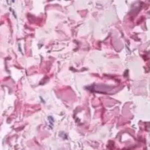 IHC mouse anti collagen v alpha 1 chain vr domain monoclonal antibody 6a7 5507