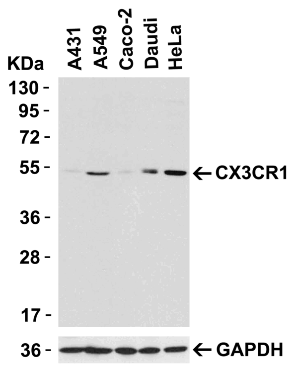 Western blot rabbit anti cx3cr1 nt polyclonal antibody 1398