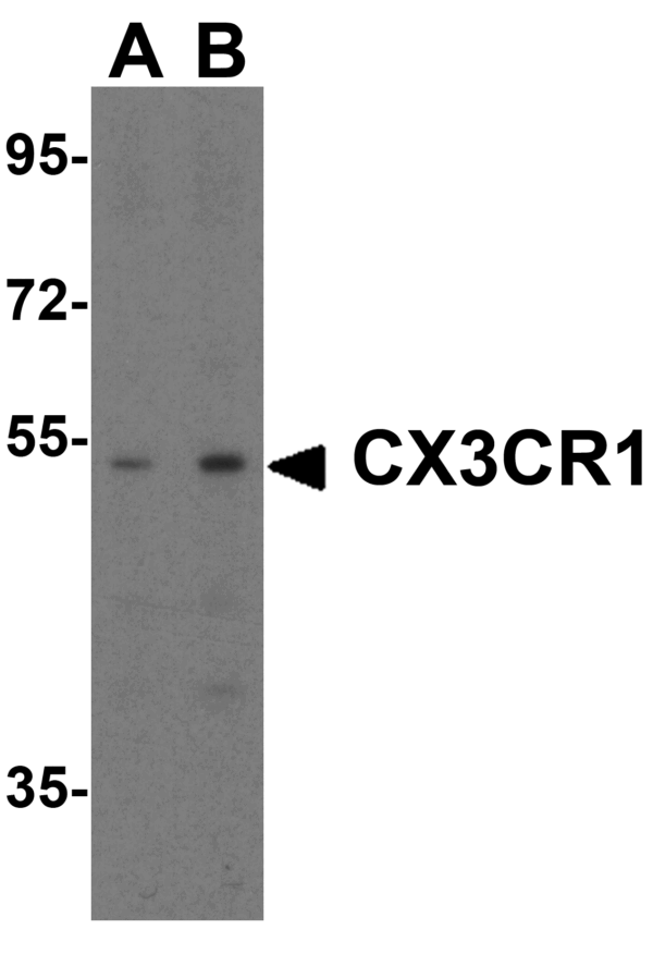 Western blot rabbit anti cx3cr1 nt polyclonal antibody 1398