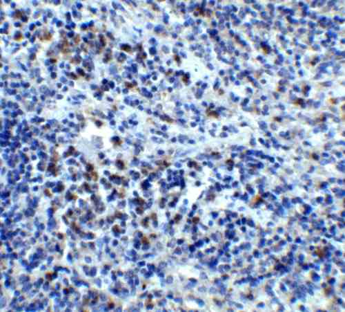 IHC rabbit anti cxcr4 el polyclonal antibody 2455