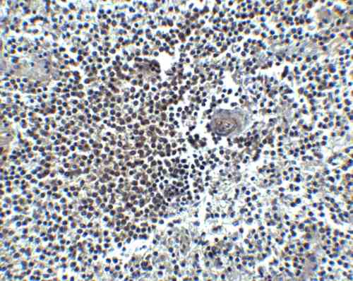 IHC rabbit anti hiv co receptor cxcr4 nt polyclonal antibody 6344