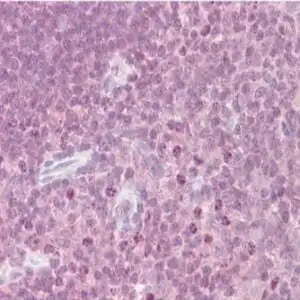 IHC mouse anti cytokine receptor like factor 2 monoclonal antibody 8h8 3284