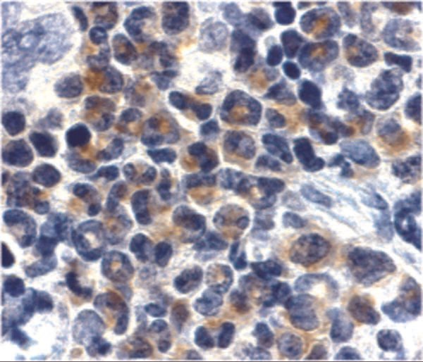 IHC rabbit anti dapk2 polyclonal antibody 5513