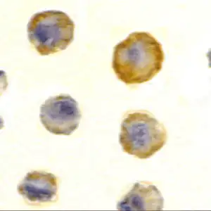 rabbit anti-DcR1 (ED) polyclonal antibody 7001