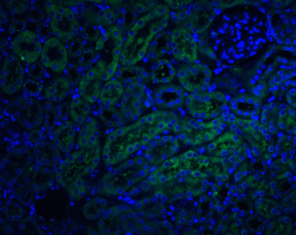 ICC/IF rabbit anti dcr2 polyclonal antibody 6363