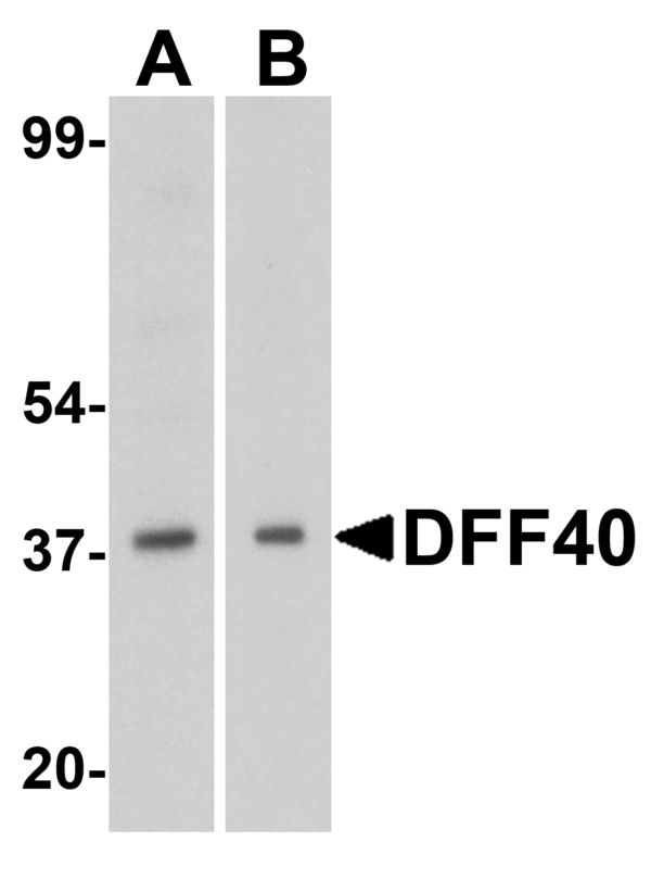 Western blot rabbit anti dff40 in polyclonal antibody 8407