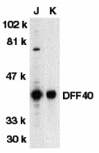 benchmark-antibodies_anti-dff40-cad_nt_antibody_6548_1.jpg