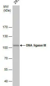 Western blot mouse anti dna ligase iii monoclonal antibody 1f3 4859