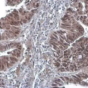 IHC mouse anti dna polymerase delta monoclonal antibody 6196 1586