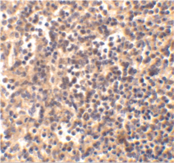 IHC rabbit anti dnase ii ct polyclonal antibody 7746