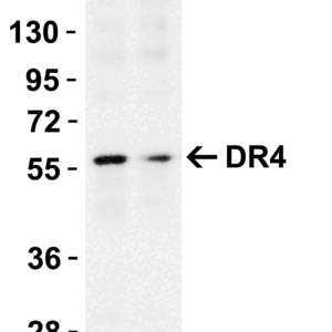 Western blot rabbit anti dr4 nt polyclonal antibody 6001
