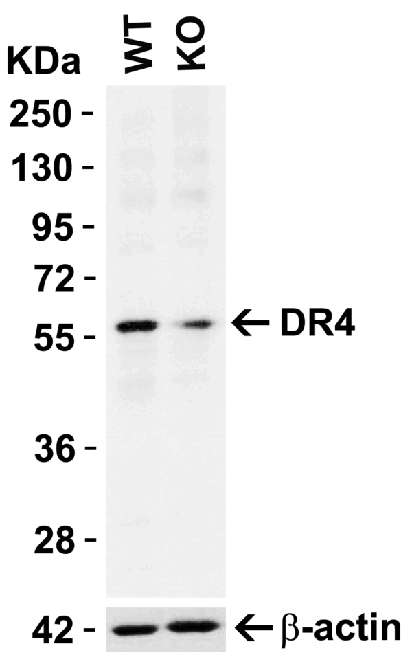 Western blot rabbit anti dr4 nt polyclonal antibody 6001