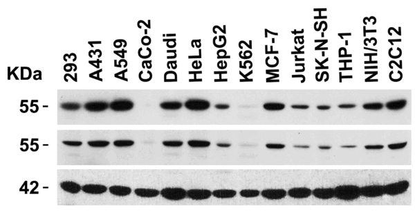 Western blot rabbit anti dr4 nt polyclonal antibody 6001