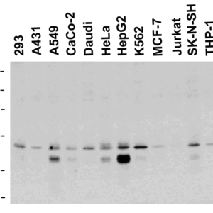 Western blot rabbit anti dr5 polyclonal antibody 9289