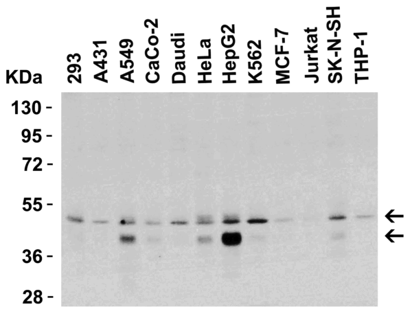 Western blot rabbit anti dr5 polyclonal antibody 9289