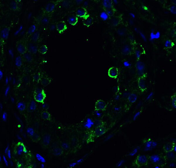 ICC/IF rabbit anti dr5 polyclonal antibody 9289