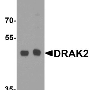 Western blot rabbit anti drak2 ct polyclonal antibody 6903