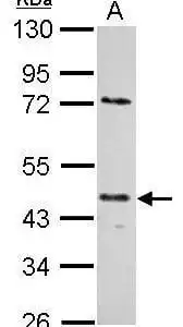 Western blot mouse anti e2f 1 monoclonal antibody 18 e10 3036