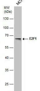Western blot mouse anti e2f 1 monoclonal antibody 6b5 3078