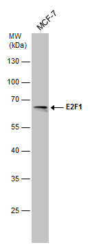 benchmark-antibodies_anti-e2f-1_antibody_3078_1.jpg