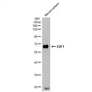 Western blot mouse anti e2f 1 monoclonal antibody 2f10 8037