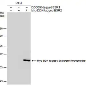 Western blot mouse anti estrogen receptor beta monoclonal antibody 6a12 8974