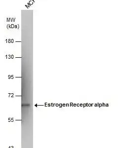 Western blot mouse anti estrogen receptor alpha monoclonal antibody 1f3 3616