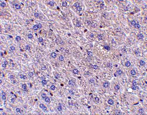 IHC rabbit anti f1a alpha ct polyclonal antibody 8308