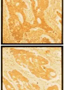 IHC mouse anti human fibronectin monoclonal antibody fn12 8 7393