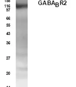 Western blot rabbit anti gaba br2 polyclonal antibody 4702