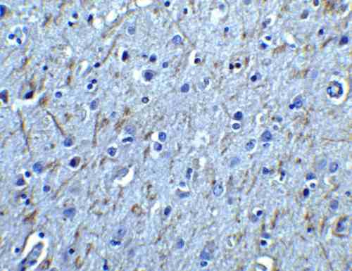 anti gfralpha 1_antibody_8851_2.gif