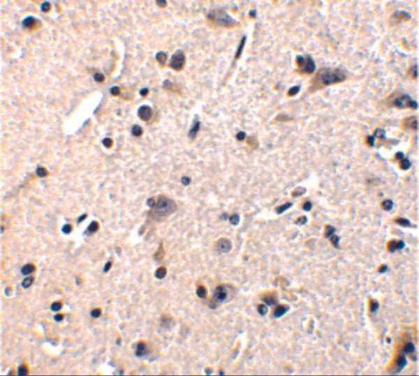 IHC rabbit anti gfr 1 in polyclonal antibody 8851