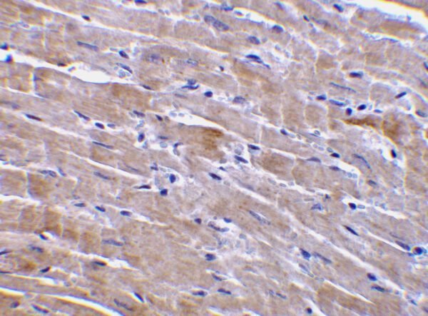 IHC rabbit anti gfr 3 in polyclonal antibody 7986