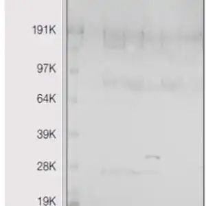 Western blot mouse anti heme oxygenase 1 monoclonal antibody gts 1 2852