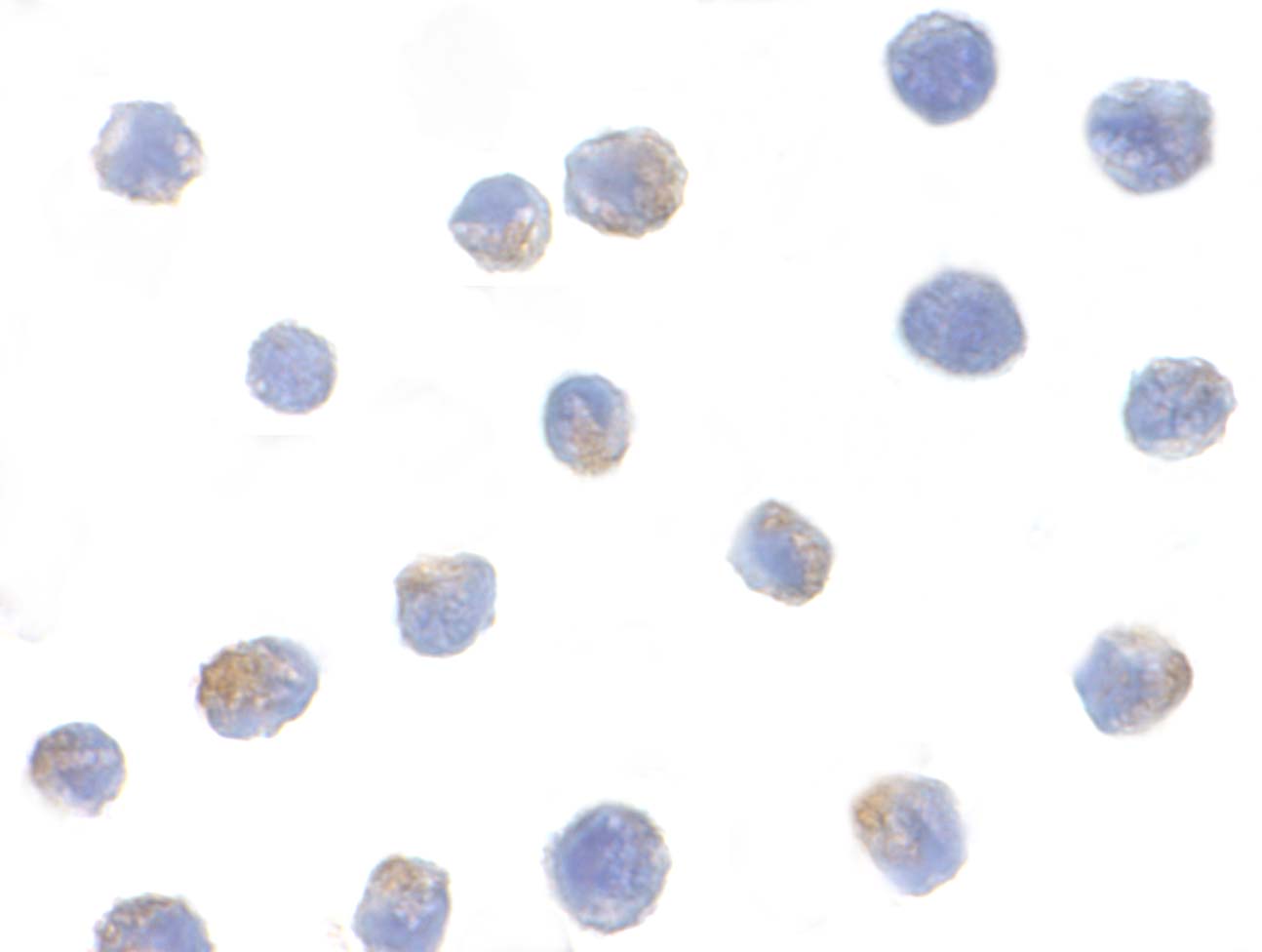 benchmark-antibodies_anti-ikkalpha_antibody_1537_2.jpg