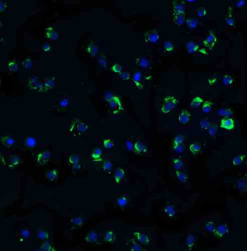 benchmark-antibodies_anti-ikkalpha_antibody_1537_4.gif