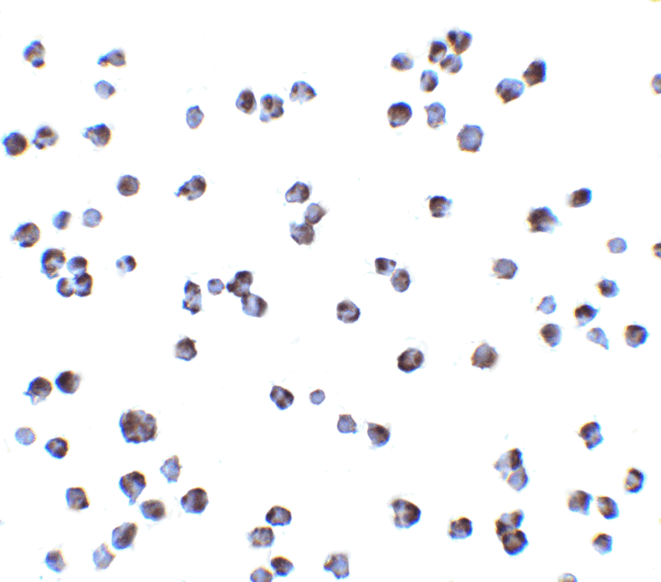 ICC/IF rabbit anti ikk alpha c1 polyclonal antibody 1537