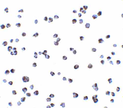 benchmark-antibodies_anti-ikkalpha_antibody_1537_5.gif